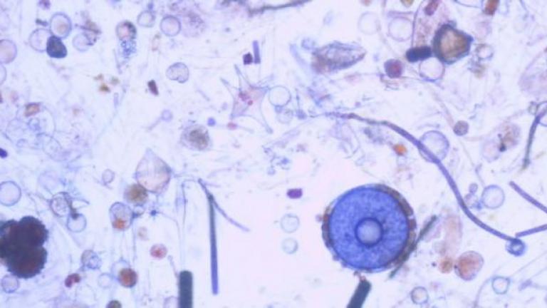 Phytoplankton on microscope slide