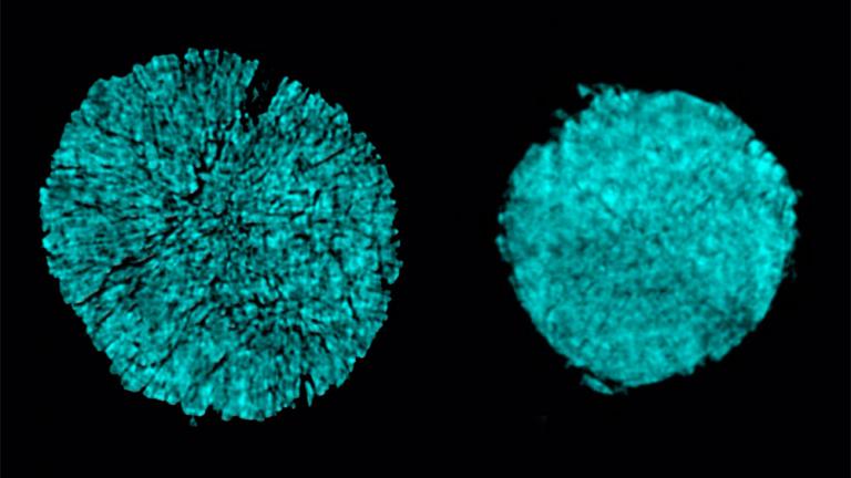 X-ray tomography images taken at Brookhaven National Lab show cracking of a particle in one electrode of a battery cell that used a conventional electrolyte (as seen on the left). The researchers found that using a novel electrolyte prevented most of this cracking (right).